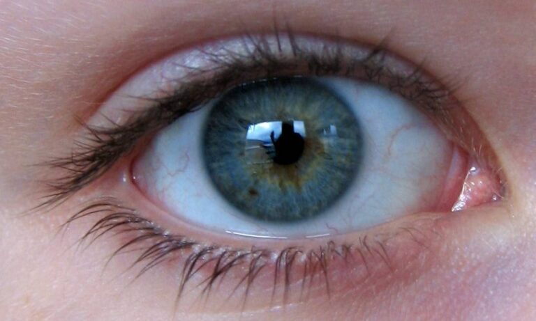 lentes de contato