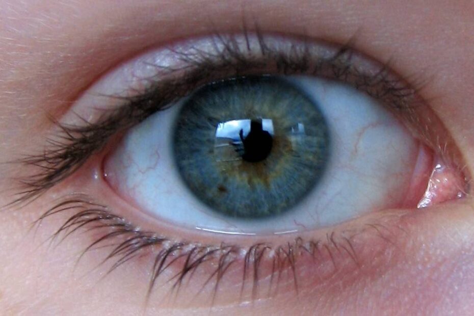 Entenda mais sobre lentes de contato anuais 9 lentes de contato